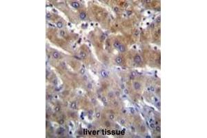 ANKRD18B Antibody (N-term) immunohistochemistry analysis in formalin fixed and paraffin embedded human liver tissue followed by peroxidase conjugation of the secondary antibody and DAB staining. (ANKRD18B antibody  (N-Term))