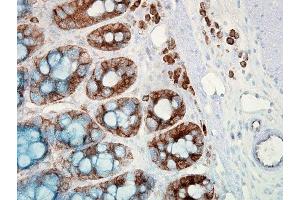 Immunohistochemistry (IHC) image for anti-Heat Shock Protein 90 (HSP90) antibody (ABIN361718)