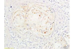 Immunohistochemistry (Paraffin-embedded Sections) (IHC (p)) image for anti-Forkhead Box O3 (FOXO3) (pSer318), (pSer321) antibody (ABIN684688)