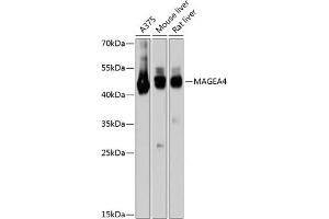 Western blot analysis of extracts of various cell lines, using M antibody (ABIN6128211, ABIN6143437, ABIN6143438 and ABIN6215295) at 1:3000 dilution. (MAGEA4 antibody  (AA 28-317))