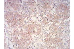 Immunohistochemistry (IHC) image for anti-PYD and CARD Domain Containing (PYCARD) (AA 1-120) antibody (ABIN5542580)
