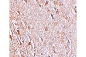Immunohistochemical staining of human brain cells with WIZ polyclonal antibody  at 2. (WIZ antibody  (C-Term))