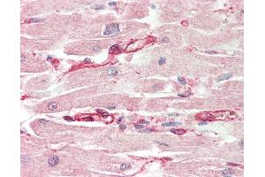 Human, Heart: Formalin-Fixed Paraffin-Embedded (FFPE). (LRRC14 antibody  (AA 412-461))