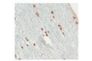 A/ [IHC-PZ] (optimal processing) human optic nerve (short post mortem interval) fixed by immersion in zinc-based fixative (BD Pharmingen 552658), processed to minimize antigen loss (shortened protocol, reduced exposure to high temperature); embedded in paraffin wax; sectioned at 3 microns  A2/ [IHC-PZ + FF] As above for initial fixation then post-fixed in 10% buffered formalin for 5 days  B/ [IHC-P] human optic nerve and spinal cord fixed in 10% buffered formalin (relatively short post mortem interval and fixation duration); standard processing; embedded in paraffin wax; sectioned at 3 microns  Controls Negative: omission of primary. (SOX10 antibody  (Middle Region))