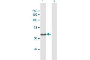 Western Blot analysis of SGPL1 expression in transfected 293T cell line by SGPL1 MaxPab polyclonal antibody. (SGPL1 antibody  (AA 1-568))