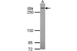 WB Image Sample (30 ug of whole cell lysate) A: Hela 5% SDS PAGE antibody diluted at 1:1000 (NOTCH3 antibody  (C-Term))