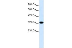 Western Blotting (WB) image for anti-Zinc Finger and BTB Domain Containing 32 (ZBTB32) antibody (ABIN2460305) (ZBTB32 antibody)