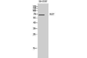 Western Blotting (WB) image for anti-SLU7 Splicing Factor Homolog (SLU7) (Internal Region) antibody (ABIN3186980) (SLU7 antibody  (Internal Region))