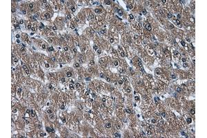 Immunohistochemical staining of paraffin-embedded liver tissue using anti-AKR1A1mouse monoclonal antibody. (AKR1A1 antibody)