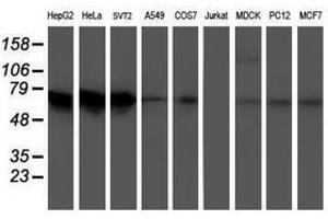 Image no. 2 for anti-5-Aminoimidazole-4-Carboxamide Ribonucleotide Formyltransferase/IMP Cyclohydrolase (ATIC) antibody (ABIN1496503)