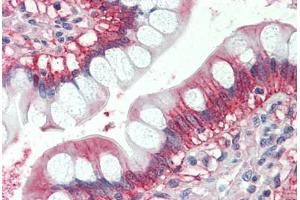 Human Small Intestine (formalin-fixed, paraffin-embedded) stained with x antibody ABIN337227 at 2. (GTPase NRas antibody  (AA 167-179))