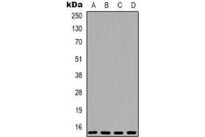 Western blot analysis of 4EBP1 expression in MCF7 (A), HEK293T (B), mouse brain (C), rat brain (D) whole cell lysates.