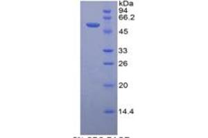 SDS-PAGE (SDS) image for Prolactin (PRL) ELISA Kit (ABIN6730926)