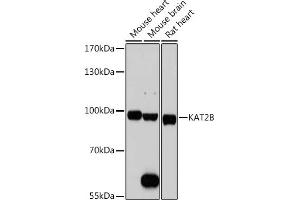 Western blot analysis of extracts of various cell lines, using KB antibody (ABIN1680550, ABIN3015032, ABIN3015033, ABIN5663568 and ABIN6213605) at 1:1000 dilution. (KAT2B antibody  (AA 583-832))