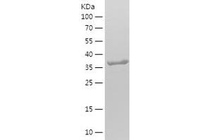 Western Blotting (WB) image for Interferon-Induced Transmembrane Protein 3 (IFITM3) (AA 1-133) protein (His-IF2DI Tag) (ABIN7282704) (IFITM3 Protein (AA 1-133) (His-IF2DI Tag))