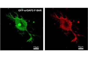 Immunofluorescence (IF) image for anti-SLIT-ROBO rho GTPase Activating Protein 2 (SRGAP2) antibody (ABIN5935194)