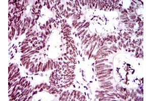 Immunohistochemistry (IHC) image for anti-Ring Finger Protein 1 (RING1) (AA 79-263) antibody (ABIN1724839)