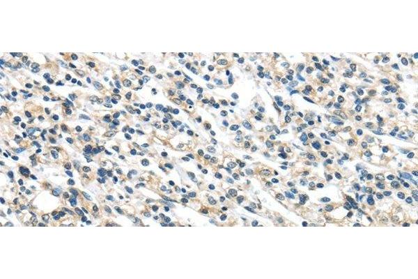 VPS36 antibody