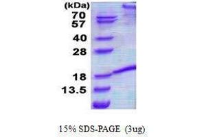 Figure annotation denotes ug of protein loaded and % gel used. (FASL Protein)