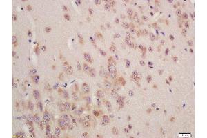 Formalin-fixed and paraffin embedded mouse brain labeled with Rabbit Anti-GSTA3 Polyclonal Antibody, Unconjugated (ABIN755767) at 1:200 followed by conjugation to the secondary antibody and DAB staining (GSTA3 antibody  (AA 131-222))