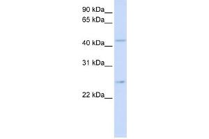 WB Suggested Anti-SLC37A4 Antibody Titration:  0.