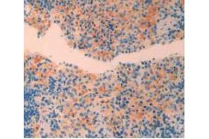 IHC-P analysis of Rat Spleen Tissue, with DAB staining.