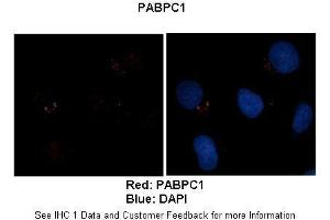 Sample Type :  Human brain stem cells (NT2)   Primary Antibody Dilution :   1:500  Secondary Antibody :  Goat anti-rabbit Alexa Fluor 594  Secondary Antibody Dilution :   1:1000  Color/Signal Descriptions :  Red: PABPC1 Blue: DAPI  Gene Name :  PABPC1  Submitted by :  Dr.