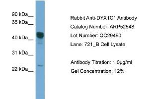 WB Suggested Anti-DYX1C1  Antibody Titration: 0. (DYX1C1 antibody  (Middle Region))