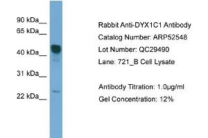 WB Suggested Anti-DYX1C1  Antibody Titration: 0.