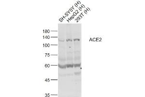 Lane 1: SH-SY5Y cell lysates; Lane 2: HepG2 cell lysates; Lane 3: 293T cell lysates probed with ACE2 Polyclonal Antibody, Unconjugated (bs-23443R) at 1:1000 dilution and 4˚C overnight incubation. (ACE2 antibody  (AA 451-550))