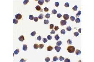 Immunocytochemical staining of K562 cells using Acinus antibody at 0. (ACIN1 antibody  (C-Term))