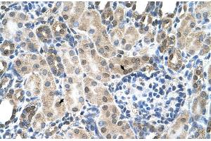 Human kidney (SLC19A1 antibody  (N-Term))