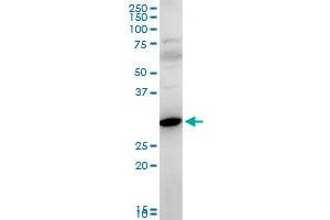 FAIM2 polyclonal antibody (A01), Lot # 051122JC01. (FAIM2 antibody  (AA 1-316))