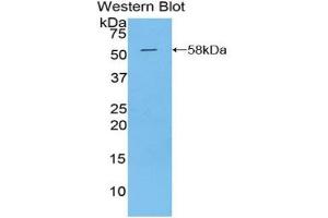 Western blot analysis of the recombinant protein. (Kallikrein 6 antibody  (AA 26-261))