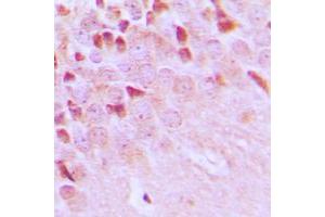 Immunohistochemical analysis of TRAF3IP1 staining in human brain formalin fixed paraffin embedded tissue section. (TRAF3IP1 antibody  (Center))