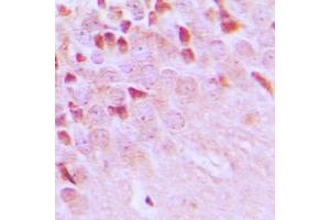 Immunohistochemical analysis of TRAF3IP1 staining in human brain formalin fixed paraffin embedded tissue section. (TRAF3IP1 antibody  (Center))