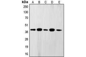 Western blot analysis of FEN1 expression in A431 (A), MCF7 (B), U937 (C), NIH3T3 (D), PC12 (E) whole cell lysates. (FEN1 antibody  (Center))