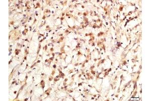 Immunohistochemistry (Paraffin-embedded Sections) (IHC (p)) image for anti-Antigen Identified By Monoclonal Antibody Ki-67 (MKI67) (AA 1201-1300) antibody (ABIN677858)