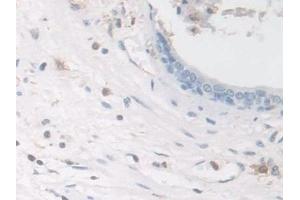 Detection of COTL1 in Human Prostate Tissue using Polyclonal Antibody to Coactosin Like Protein 1 (COTL1) (COTL1 antibody  (AA 1-142))