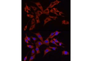 Immunofluorescence analysis of NIH/3T3 cells using S6 Ribosomal Protein (RPS6) Rabbit mAb (ABIN7270026) at dilution of 1:100 (40x lens). (RPS6 antibody)