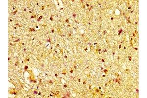 IHC image of ABIN7170335 diluted at 1:600 and staining in paraffin-embedded human brain tissue performed on a Leica BondTM system. (Sortilin 1 antibody  (AA 328-457))