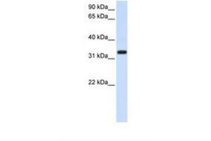 TMEM66 anticorps  (AA 218-267)