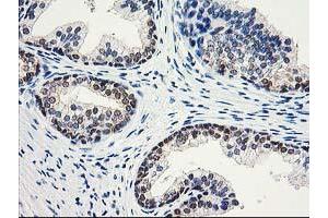 Image no. 7 for anti-Aminoacylase 1 (ACY1) antibody (ABIN1496454) (Aminoacylase 1 antibody)