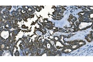 IHC analysis of CDC45L using anti-CDC45L antibody (ABIN7600230). (CDC45 antibody  (AA 166-431))