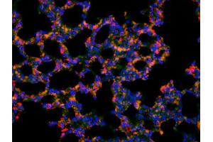 Formalin-fixed and paraffin-embedded mouse lung labeled with Anti-Phospho-EphA2 (Tyr594) Polyclonal Antibody, Unconjugated (ABIN684508) 1:200, overnight at 4°C, The secondary antibody was Goat Anti-Rabbit IgG,Cy3 conjugated used at 1:200 dilution for 40 minutes at 37°C. (EPH Receptor A2 antibody  (pTyr594))