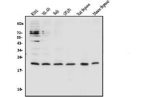 Western blot analysis of CD69 using anti-CD69 antibody (ABIN7599623). (CD69 antibody  (AA 101-148))