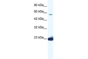 DDX55 antibody used at 1.
