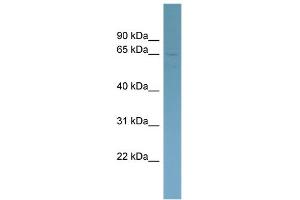 WB Suggested Anti-HOMEZ Antibody Titration:  0. (HOMEZ antibody  (Middle Region))