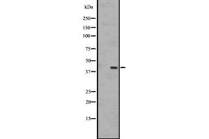 Western blot analysis of EBI2 expression in A431 whole cell lysate ,The lane on the left is treated with the antigen-specific peptide. (GPR183 antibody  (Internal Region))