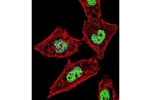 Fluorescent confocal image of Hela cell stained with RORA Antibody (T216). (RORA antibody  (AA 193-222))